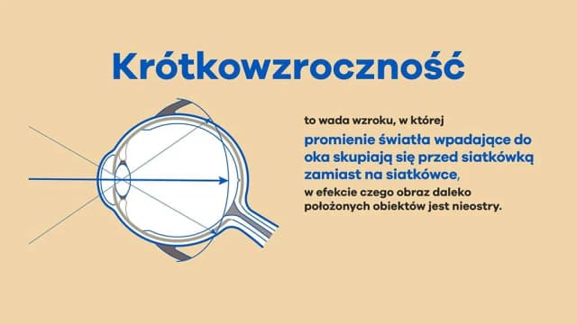 Jaka jest najmniejsza wada wzroku i jak wpływa na codzienne życie Jaka jest najmniejsza wada wzroku i jak wpływa na codzienne życie