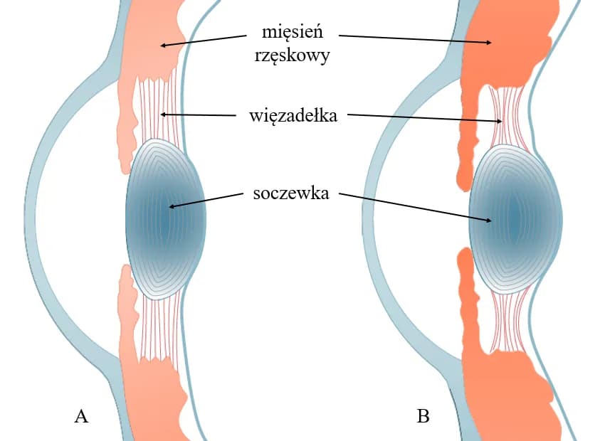 Jak działa soczewka oka i dlaczego ma kluczowe znaczenie dla wzroku Jak działa soczewka oka i dlaczego ma kluczowe znaczenie dla wzroku